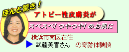 アトピー性皮膚炎体験談
